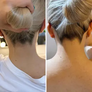 うなじ脱毛/美肌脱毛 LABELのエステ・リラクイメージ