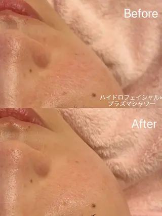 アイラッシュ&エステサロンLinda西宮所属・小顔&毛穴・肌質改善 LINDA西宮 AIのエステ・リラクイメージ