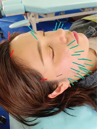 小顔美容鍼専門サロン 渋谷YZのエステ・リラクイメージ