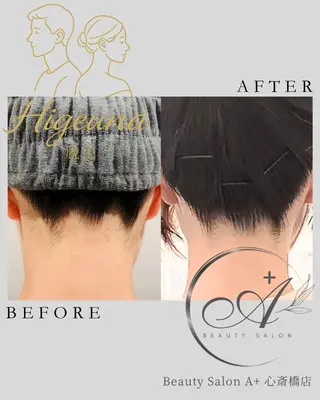 BeautysalonA所属・うなじ脱毛/ つや肌ハーブのエステ・リラクイメージ