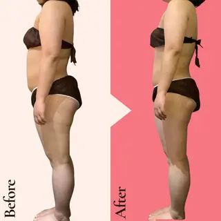 痩身ダイエット専門店 プレシャスのエステ・リラクイメージ