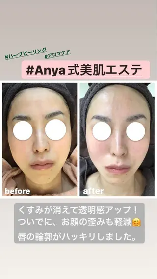 Anya Beautyのエステ・リラクイメージ