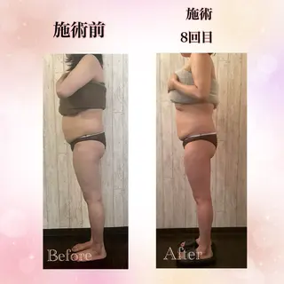 Total Beauty  ラトゥール所属・ラトゥール Maiのエステ・リラクイメージ