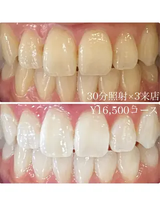 メンズ ホワイトニングルーム　川崎店所属・ホワイトニング ルーム　川崎店のその他イメージ