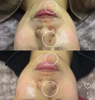 美肌・小顔専門🪄 看護師施術/松﨑のエステ・リラクイメージ