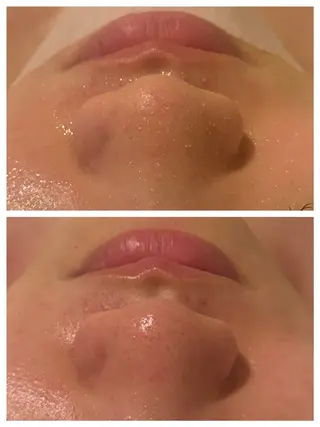 痩身・小顔・脱毛・ オイル&Amourのエステ・リラクイメージ