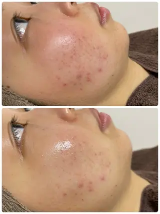 beauty salon LINOBELLE所属・美肌改善専門サロン LINOBELLEのエステ・リラクイメージ