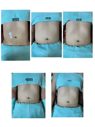 メンズ CHOUETTE所属・五島 久美子のエステ・リラクイメージ