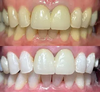 io teeth careのその他イメージ