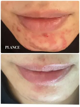 フェイシャル専門 肌質改善/プランスのエステ・リラクイメージ