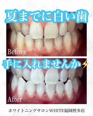 キッズ メンズ セルフホワイトニング WHITE福岡博多店のエステ・リラクイメージ