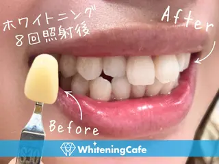 ホワイトニングカフェ徳島沖浜店所属・ホワイトニングカフェ 徳島沖浜店のエステ・リラクイメージ