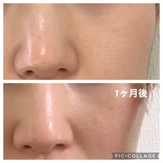 メナードフェイシャルサロン犬山橋爪店所属・メナード谷口 春香のエステ・リラクイメージ