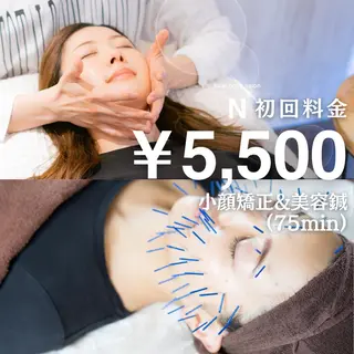 美容鍼・小顔/ 骨盤矯正/目黒/レンのエステ・リラクイメージ