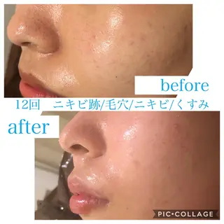 ロング カラー パーマ ヘアアレンジ キッズ ネイル マツエク・マツパ Ensor Clair所属・EnsorClair 代表　野口真央のエステ・リラクイメージ