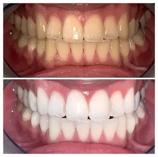 ヘアアレンジ ネイル マツエク・マツパ メンズ カラー パーマ アイブロウ キッズ ショート ライトビューティー 銀座店のエステ・リラクイメージ