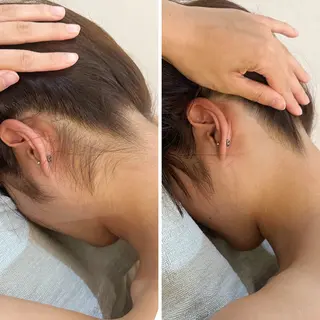 うなじ脱毛/美肌脱毛 LABELのエステ・リラクイメージ