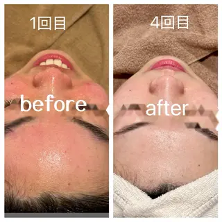 ANERA Second所属・尾上 沙織のエステ・リラクイメージ