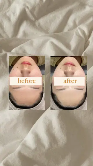 crescent所属・【韓国肌管理・脱毛】 クレセントのその他イメージ