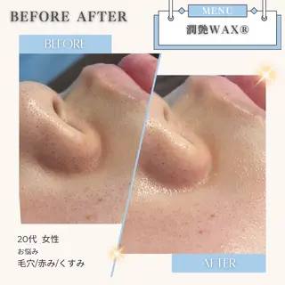 美白/韓国肌管理 💎 KOTOMIのエステ・リラクイメージ