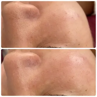 Chalon所属・REVI取扱・肌悩み 毛穴Chalonのエステ・リラクイメージ