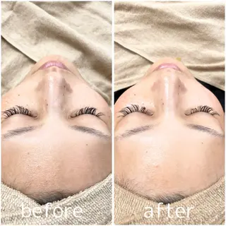 N eyes所属・N eyes (エヌアイズ)のエステ・リラクイメージ