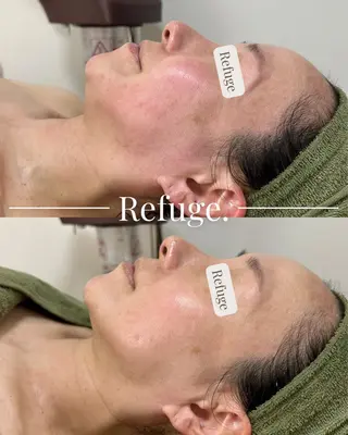 グリーンピール専門サロン Refuge.所属・Refuge. （リフュージュ）のエステ・リラクイメージ