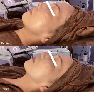 アプローズ所属・恵比寿INDIBA アプローズのエステ・リラクイメージ