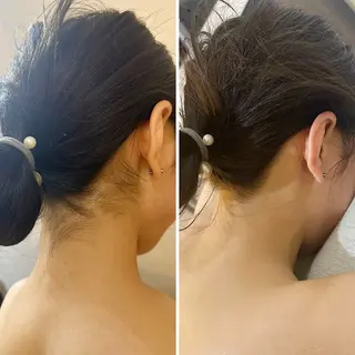 うなじ脱毛/美肌脱毛 LABELのエステ・リラクイメージ