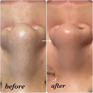 salon akua nail＆リラクのネイルデザイン