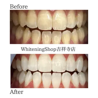 ホワイトニング ショップ吉祥寺店のエステ・リラクイメージ