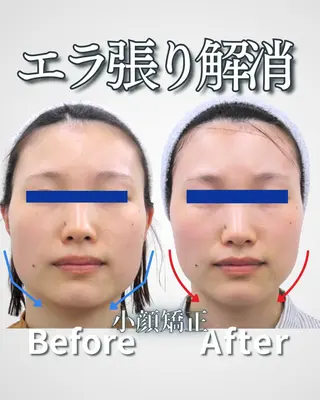 銀座美.design 神戸三宮店のエステ・リラクイメージ