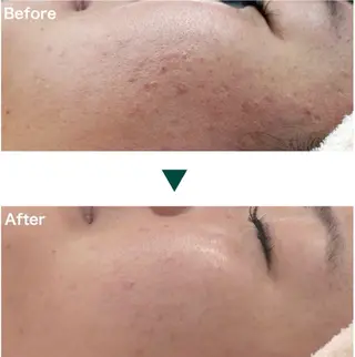 エステサロンNOAH所属・肌育＋脱毛 tomoのエステ・リラクイメージ