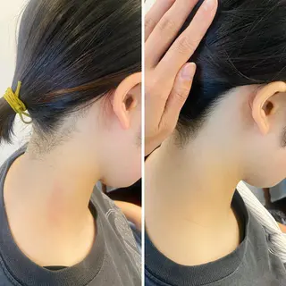 カラー うなじ脱毛/美肌脱毛 LABELのエステ・リラクイメージ