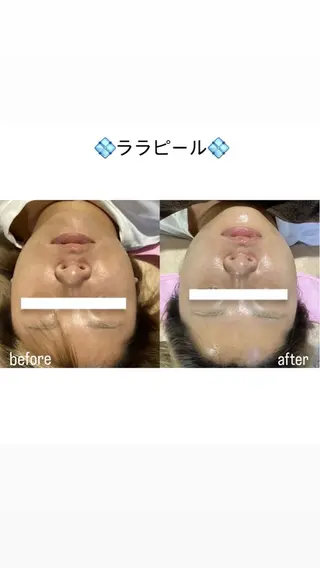 salon merci和泉のエステ・リラクイメージ