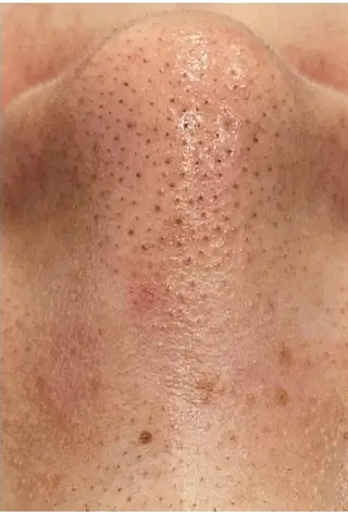 東京ビューティー 五反田店　nanaのエステ・リラクイメージ