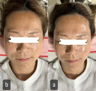 217whitening  room所属・217 ホワイトニングルームのエステ・リラクイメージ