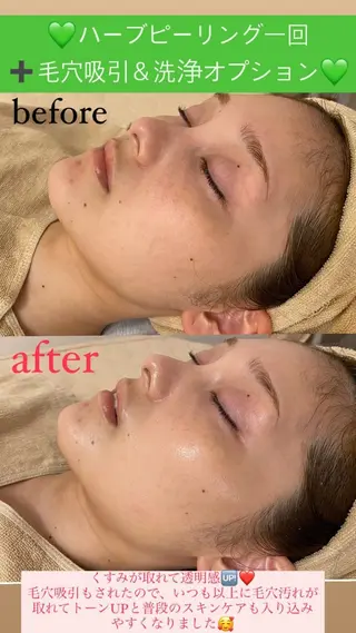 メンズ Salon de Lino 御器所のエステ・リラクイメージ