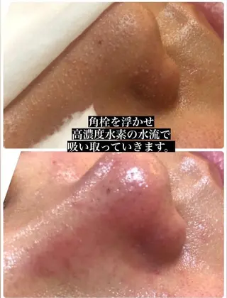 美顔秘密基地新宮所属・美顔秘密基地 新宮のその他イメージ