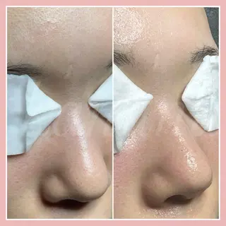 kanunu♡mana所属・豊橋/毛穴特化エステ 深層デトックスリンパのエステ・リラクイメージ