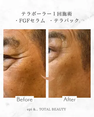 epi &... TOTAL BEAUTY所属・epi &... Harukaのエステ・リラクイメージ