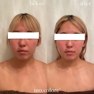 エステサロンino.colore'所属・小顔サロン ino.coloreのエステ・リラクイメージ