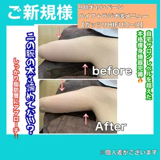 痩身/脱毛/ネイル HARUKAのエステ・リラクイメージ