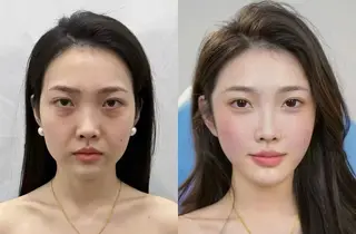 メンズ ネイル aliaハイフ&水光ジェットサロン所属・aliaハーブ水光店 エステティシャン募集のエステ・リラクイメージ