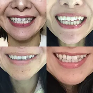 西宮ホワイトニング Kirarie所属・志水 有美のエステ・リラクイメージ