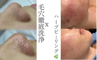 LUMINAESTH所属・LUMINA ESTHのエステ・リラクイメージ