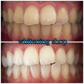 メンズ ホワイトニング ショップ川越店のエステ・リラクイメージ