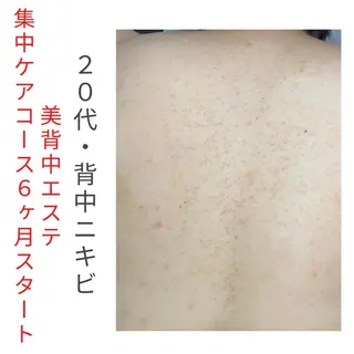 ベラージュ【美背中・ 美尻・フェイシャル】のエステ・リラクイメージ