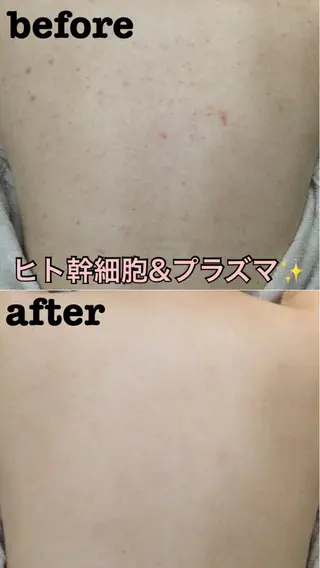 salon A.glansh所属・肌質改善salon♪ 効果がわかる♪南森町のネイルデザイン