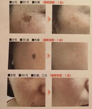 🅖🅤🅩🅔🅛 salonのエステ・リラクイメージ